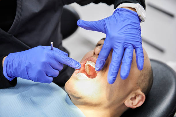Best Emergency Treatment for Toothache in Washington, MO