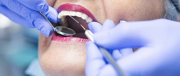 Best Emergency Treatment for Toothache in Washington, MO